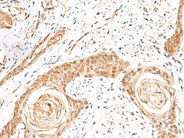 ELF3 Polyclonal Antibody (E-AB-52915)