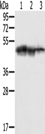 SMARCB1 Polyclonal Antibody (E-AB-11593)