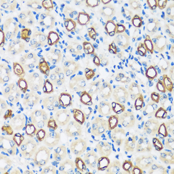 AQP2 Polyclonal Antibody (E-AB-66725)