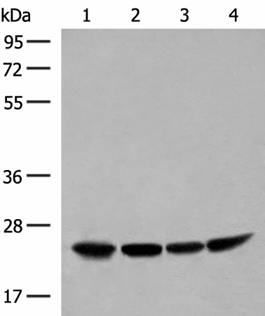 DTYMK Polyclonal Antibody (E-AB-18798)