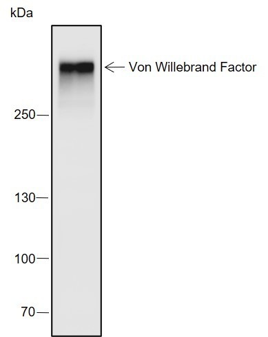 Recombinant Von Willebrand Factor Monoclonal Antibody (AN301967L)
