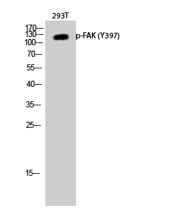 Phospho-FAK (Tyr397) Polyclonal Antibody (E-AB-21207)