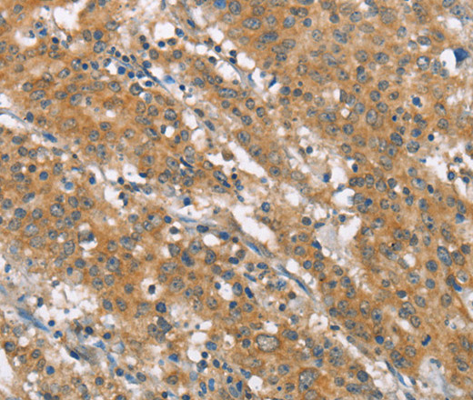 NLRP7 Polyclonal Antibody (E-AB-13071)