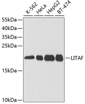(KO Validated) LITAF Polyclonal Antibody (E-AB-60978)
