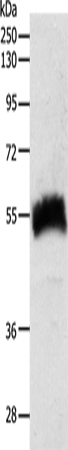 SLC22A6 Polyclonal Antibody (E-AB-12825)