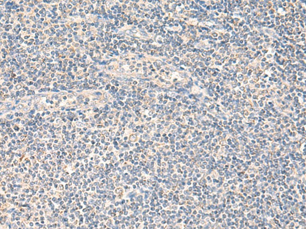 NEGR1 Polyclonal Antibody (E-AB-18950)