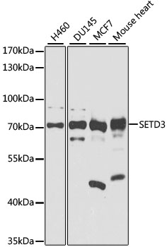 SETD3 Polyclonal Antibody (E-AB-92418)