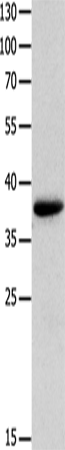 MYOZ1 Polyclonal Antibody (E-AB-14230)