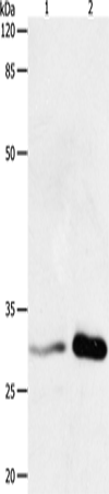 14-3-3 beta/alpha Polyclonal Antibody (E-AB-12216)