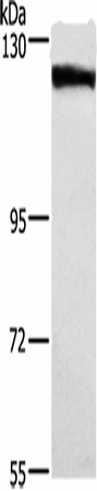 DSG1 Polyclonal Antibody (E-AB-16389)