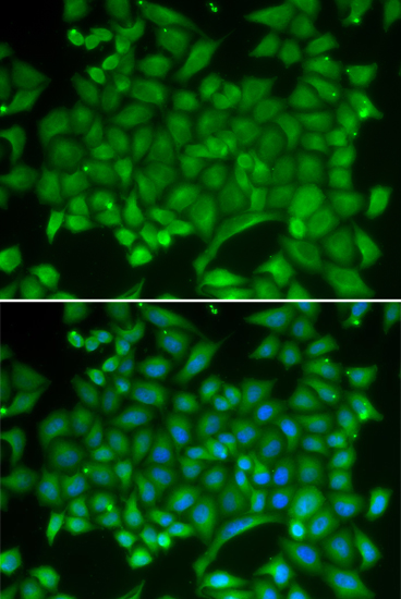 RAB11A Polyclonal Antibody (E-AB-60226)