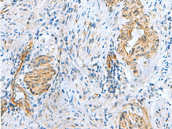 NMU Polyclonal Antibody (E-AB-53063)