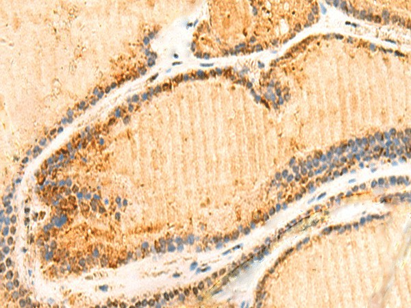 ZNF581 Polyclonal Antibody (E-AB-52844)