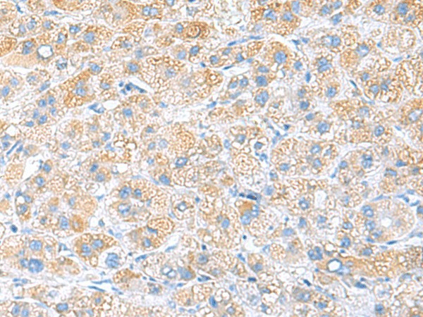 RPS16 Polyclonal Antibody (E-AB-53044)