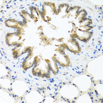 S100A7 Polyclonal Antibody (E-AB-62206)
