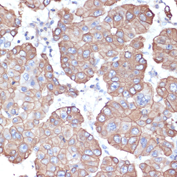 Cytokeratin-18 Polyclonal Antibody (E-AB-64048)