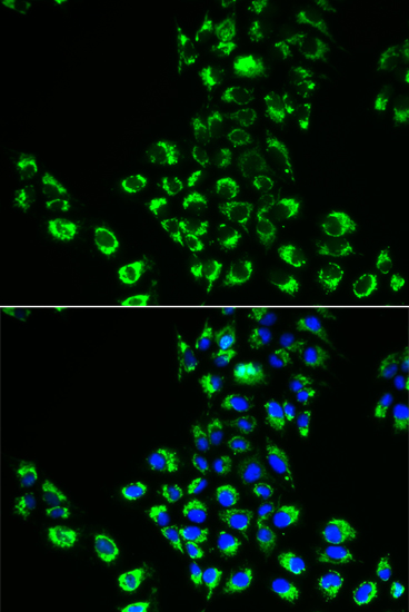 EIF5B Polyclonal Antibody (E-AB-62317)