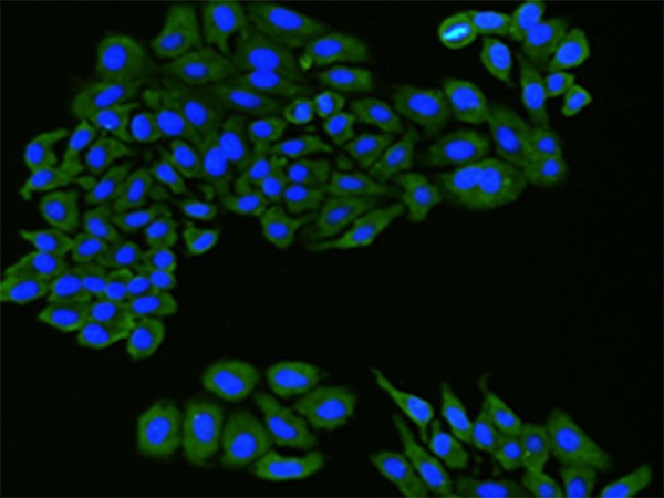 FLT1 Polyclonal Antibody (E-AB-53194)
