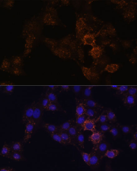 GRP Polyclonal Antibody (E-AB-61920)
