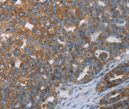 CERS4 Polyclonal Antibody (E-AB-16560)