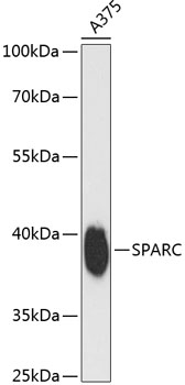 SPARC Polyclonal Antibody (E-AB-65014)