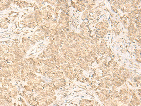 IL32 Polyclonal Antibody (E-AB-19810)