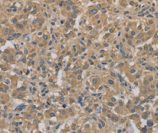 AGTRAP Polyclonal Antibody (E-AB-10755)