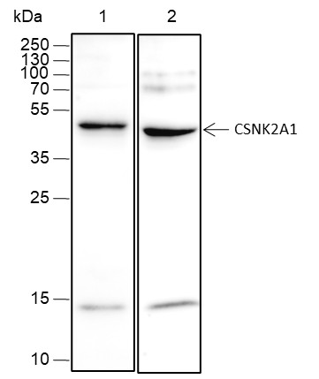 Recombinant CSNK2A1 Monoclonal Antibody (AN301754L)