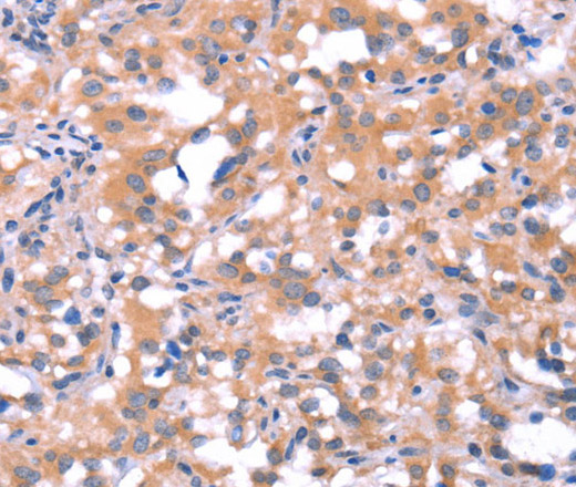 FAT1 Polyclonal Antibody (E-AB-13237)