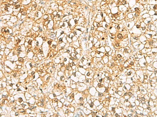 C11orf54 Polyclonal Antibody (E-AB-53128)