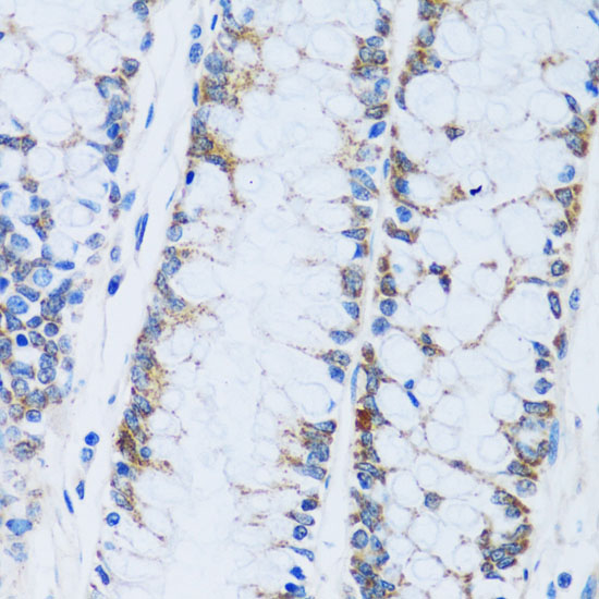 CA13 Polyclonal Antibody (E-AB-65009)
