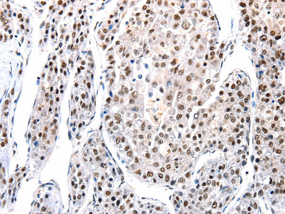 AQP2 Polyclonal Antibody (E-AB-12274)