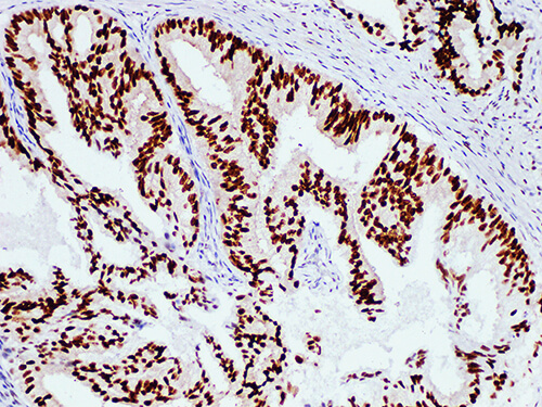 AR Monoclonal Antibody (ELAB6568-M)