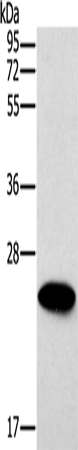 ERAS Polyclonal Antibody (E-AB-13219)