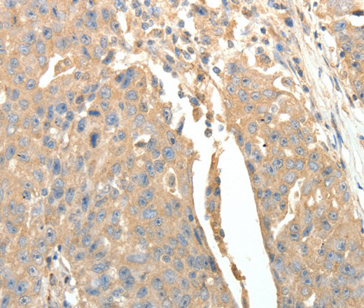 SFTPD Polyclonal Antibody (E-AB-14367)