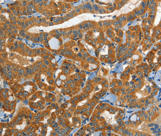 EPHB3 Polyclonal Antibody (E-AB-12754)