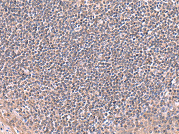 RIC8A Polyclonal Antibody (E-AB-52943)