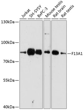 F13A1 Polyclonal Antibody (E-AB-65050)
