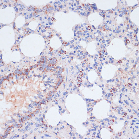 VASP Polyclonal Antibody (E-AB-66251)