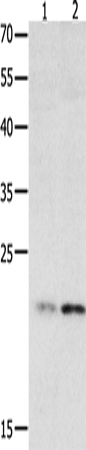HMGB4 Polyclonal Antibody (E-AB-14128)