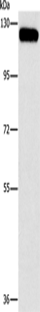 CBL Polyclonal Antibody (E-AB-13099)