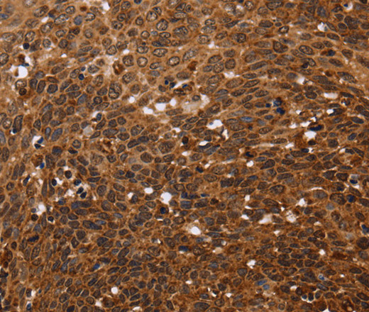 FANCF Polyclonal Antibody (E-AB-15015)