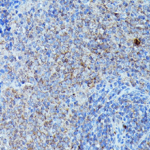 CSF3 Polyclonal Antibody (E-AB-67732)