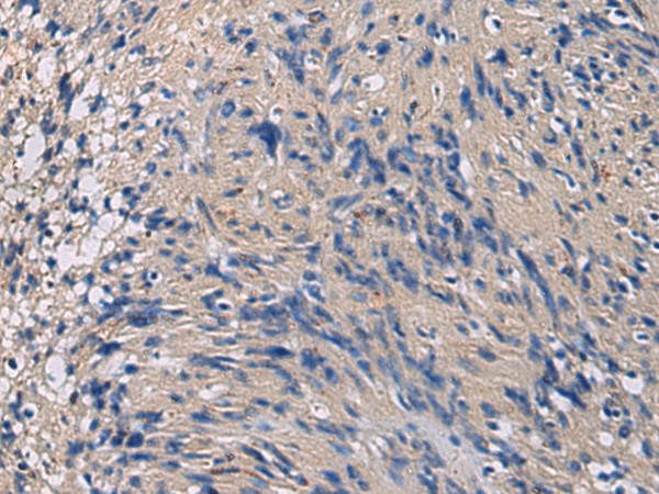 CHST3 Polyclonal Antibody (E-AB-17802)