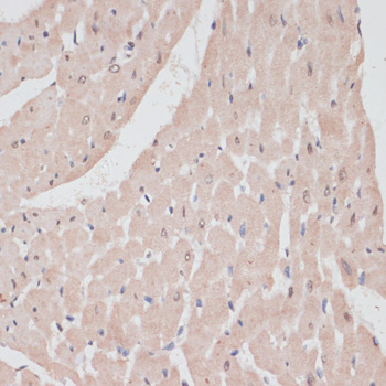 PRPF31 Polyclonal Antibody (E-AB-61089)
