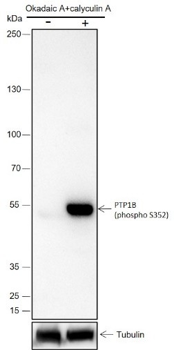 Recombinant Phospho-PTP1B (Ser352) Monoclonal Antibody (AN302077L)