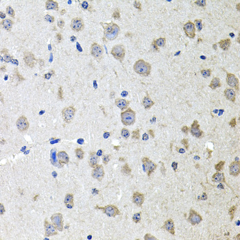 ALPL Polyclonal Antibody (E-AB-65787)