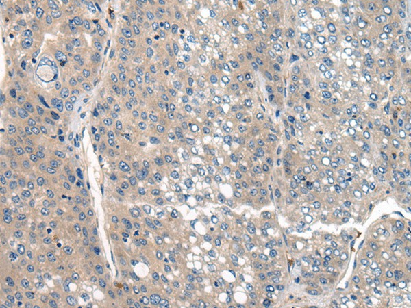 CLTCL1 Polyclonal Antibody (E-AB-17805)