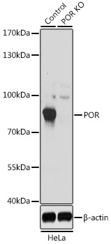 (KO Validated) POR Polyclonal Antibody (E-AB-62876)