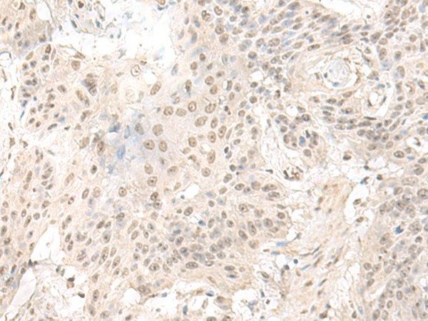 ILKAP Polyclonal Antibody (E-AB-18704)